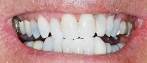After Dental Care Treatment Medford