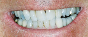 Before Dental Care Treatment Medford