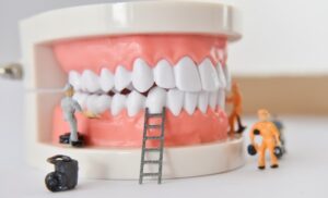 What Does It Takes to Get Dental Implants? Gallery What Does It Takes to Get Dental Implants