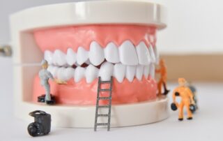 What Does It Takes to Get Dental Implants? Gallery What Does It Takes to Get Dental Implants