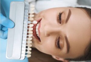 Dental Veneers Medford