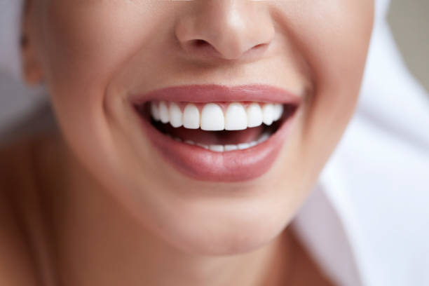 Teeth Whitening Medford