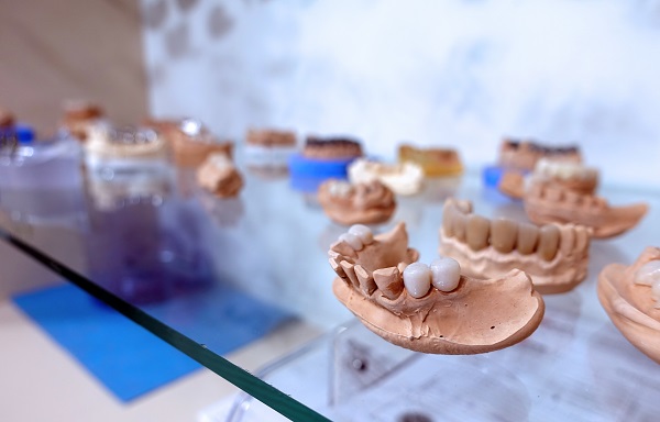 Dental Veneers: Porcelain Veneer Uses, Procedure, and More