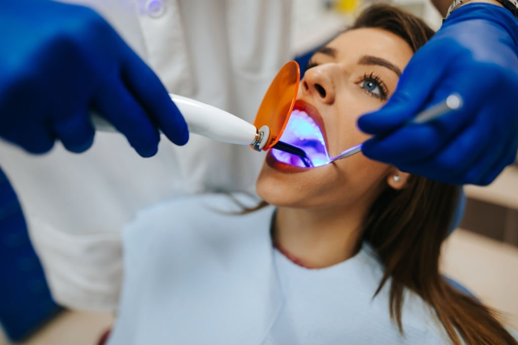 Will My Dental Insurance Cover a Root Canal Treatment?
