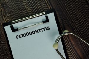 Is Chronic Inflammatory Periodontitis A Failure To Resolve