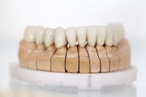 Dental Implants: The Fastest Way To Get A Perfect Smile