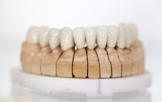 Dental Implants: The Fastest Way To Get A Perfect Smile