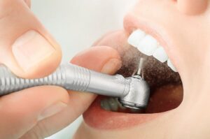 Teeth Cleaning Medford