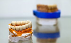 Dental Crown & Bridgework Medford