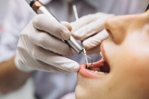 Teeth Cleaning Medford