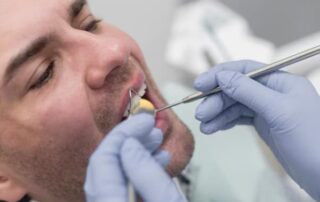 Medford Dental Bonding