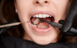 Medford Dental Fillings