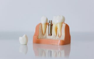 dental implants in Medford
