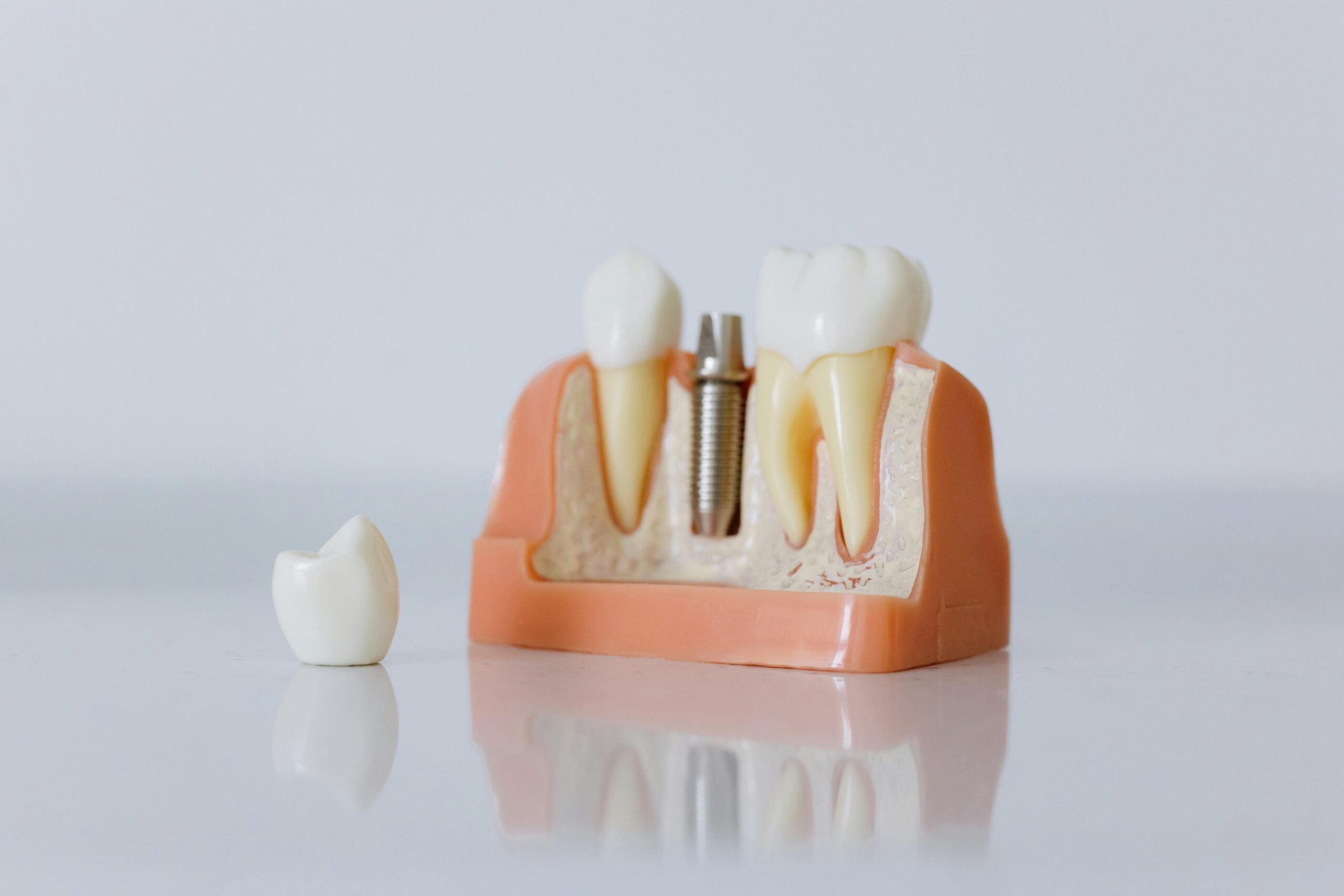 dental implants in Medford