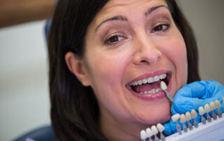 dental implants